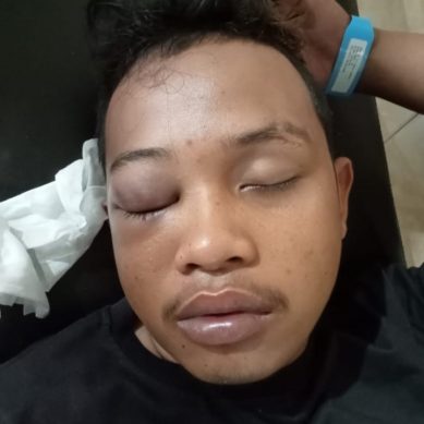 Oknum Polantas Bone Bolanggo Diduga Aniaya Warga Boliyohuto