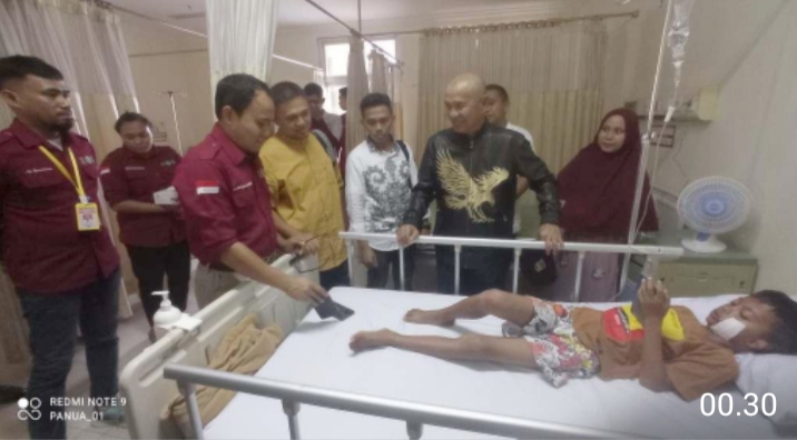 Proses Operasi Celah Bibir Dan Lelangit Warga Pohuwato Di Makasar, Di Pantau Langsung Bupati Saipul Mbuinga