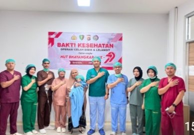 Sambut Hari Bhayangkara ke-79, Polda Gorontalo Gelar Operasi Bibir Sumbing Gratis untuk 21 Anak